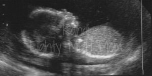Randi's Ultrasound