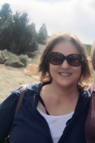 How can I stop my hair from thinning? Here's what worked for me