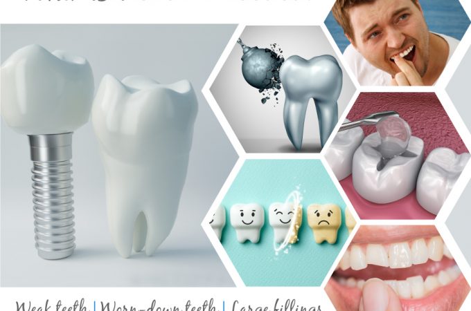 When is a dental crown needed infographic