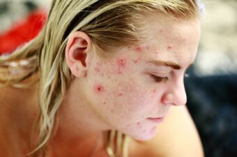 treat common skin conditions